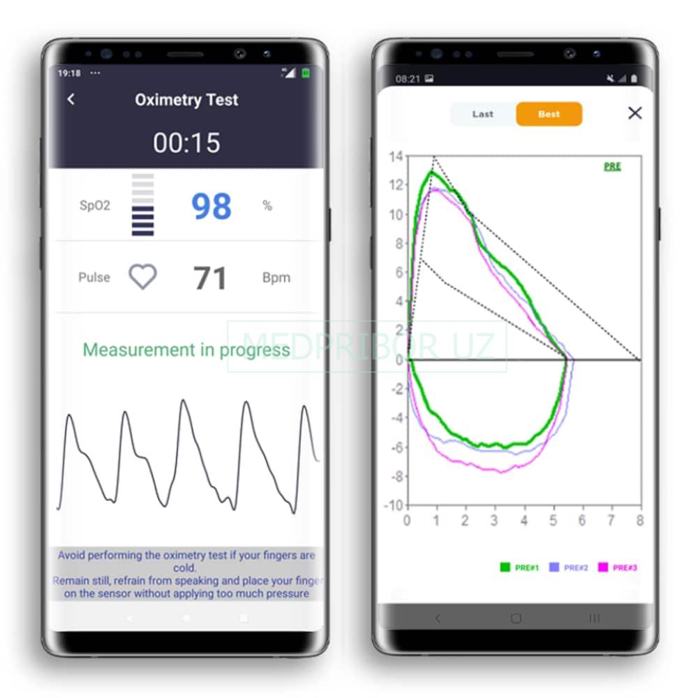 Mir Spirobank Smart - спирометр портативный3 Mir Spirobank Smart - спирометр портативный