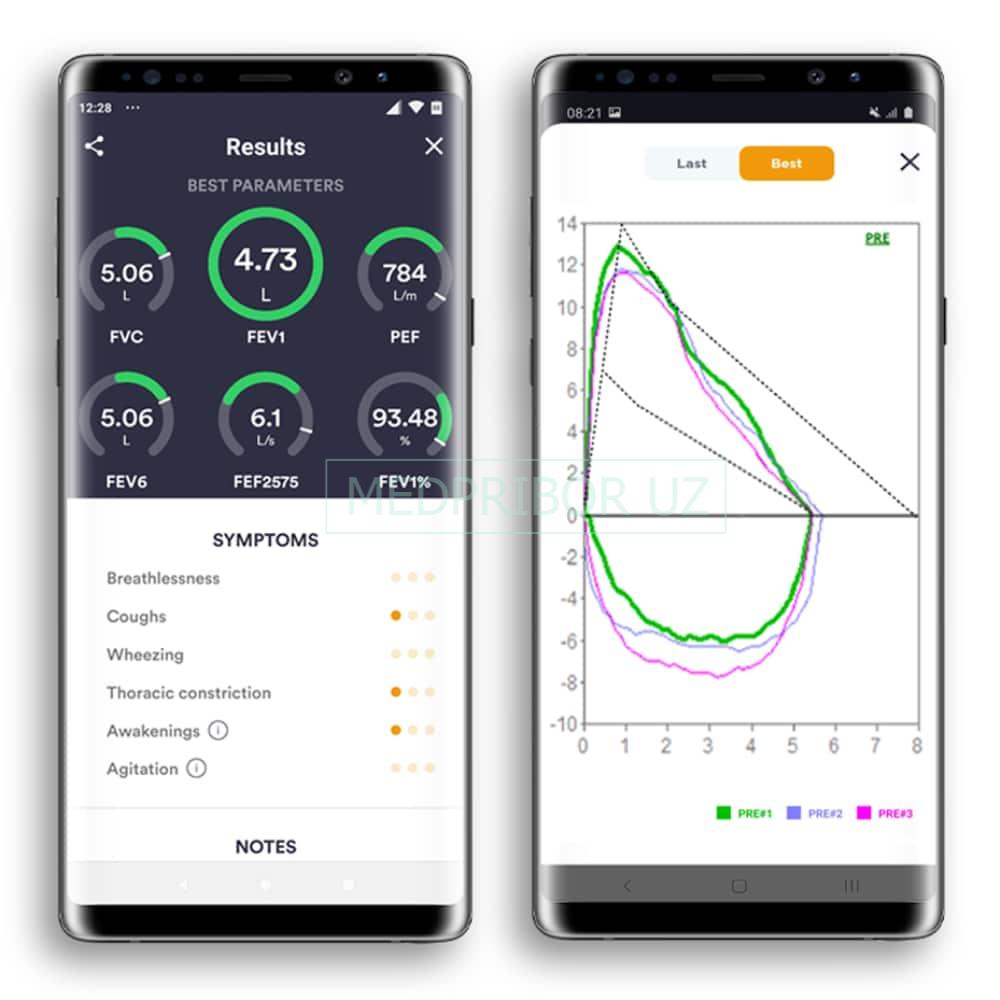 Mir Spirobank Smart - спирометр портативный Mir Spirobank Smart - спирометр портативный
